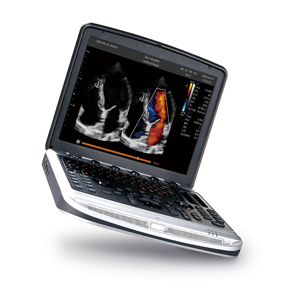 SonoBook 6