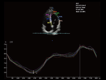 Strain and Strain Rate