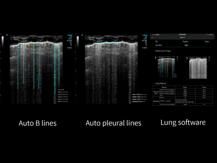 Professional lung software